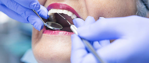 Best Emergency Wisdom Teeth Removal in Swartz Creek, MI